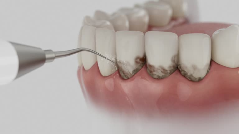 Reliable Dental Implants contractor in Hollandale, MS by Smile Center Dentistry